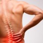 Using PRP to Stop Your Back from&nbsp;Aching